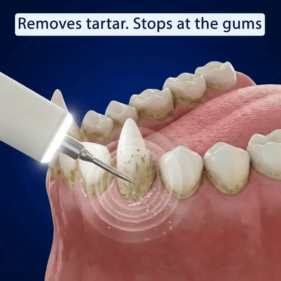 Remove tartar from the very first session, with total confidence